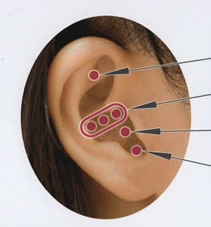 日本痩身医学協会の耳つぼダイエットで使用する耳のツボ